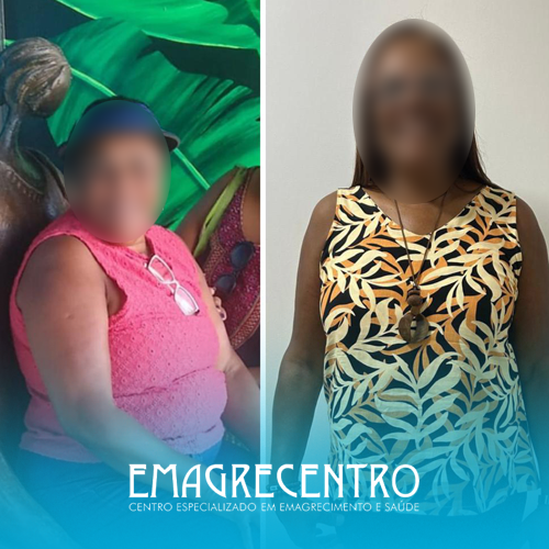 Emagrecentro-Antes-e-Depois-#01