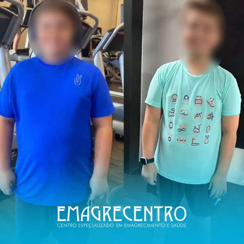 Emagrecentro-Antes-e-Depois-#02