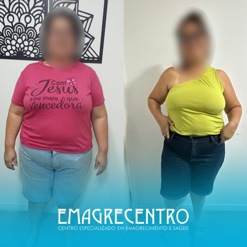 Emagrecentro-Antes-e-Depois-#03