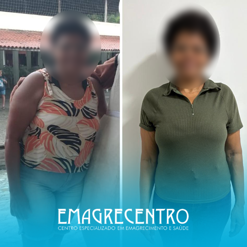Emagrecentro-Antes-e-Depois-#04