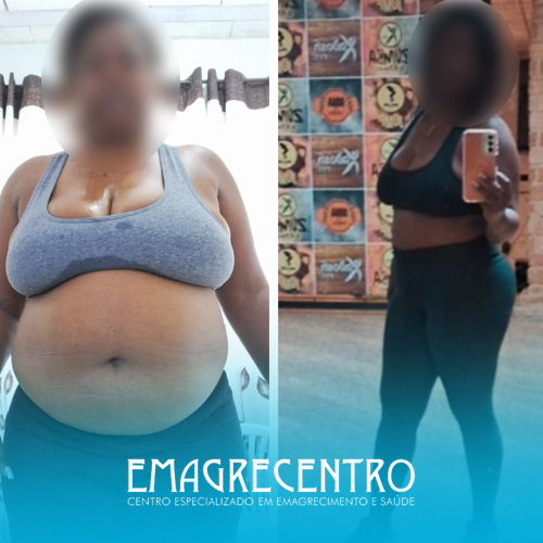 Emagrecentro-Antes-e-Depois-#05