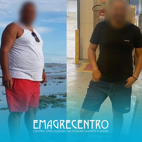 Emagrecentro-Antes-e-Depois-#06