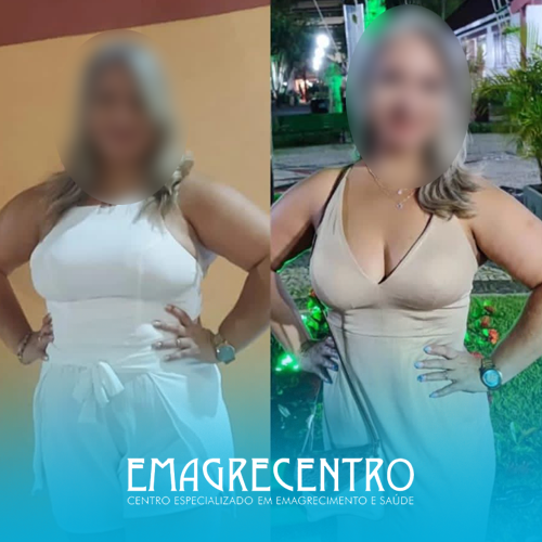 Emagrecentro-Antes-e-Depois-#07