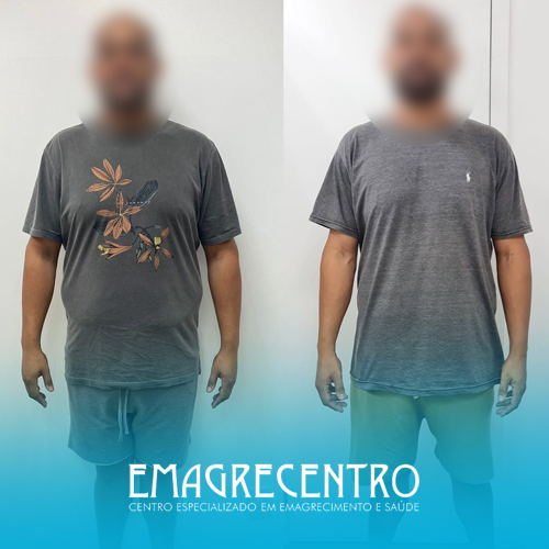 Emagrecentro-Antes-e-Depois-#08